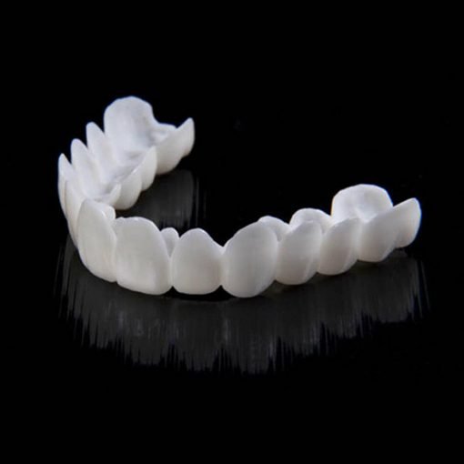 Snap on Smile Veneers Tandtransformatie Tanden