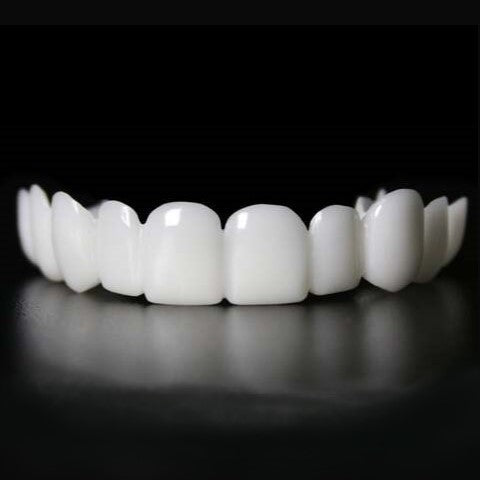 Snap on Smile Veneers Tandtransformatie Tanden