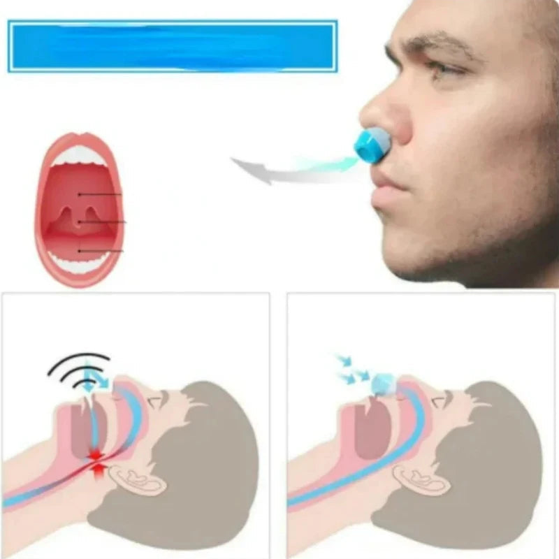 Anti-Snor Neusclip Luchtzuiveraar 2-in-1