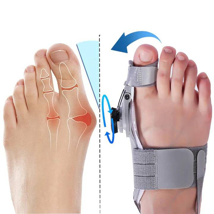 Bunion Corrector Tussenruimte voor Tenen