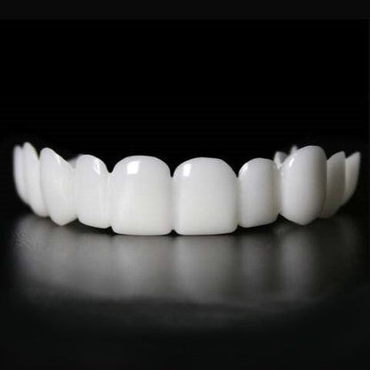 Snap on Smile Veneers Tandtransformatie Tanden