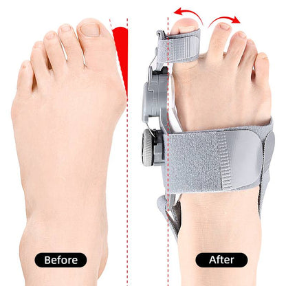 Bunion Corrector Tussenruimte voor Tenen