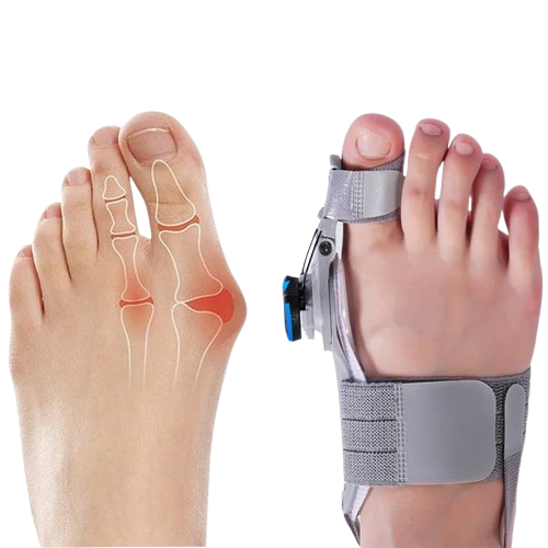 Bunion Corrector Tussenruimte voor Tenen
