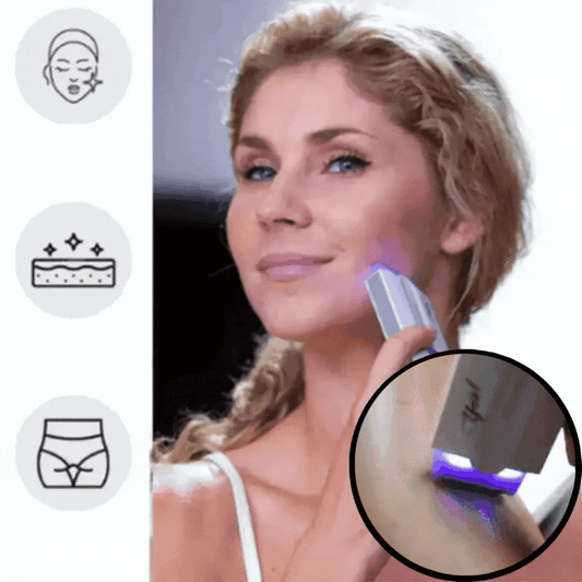 Laser ontharingsapparaat IPL technologie pijnloos