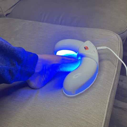 Nagel Laser Schimmelapparaat voor Schimmelverwijdering