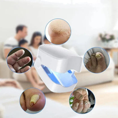 Nagelschimmel Reinigingslaserapparaat Lichttherapie Teennagelziekten